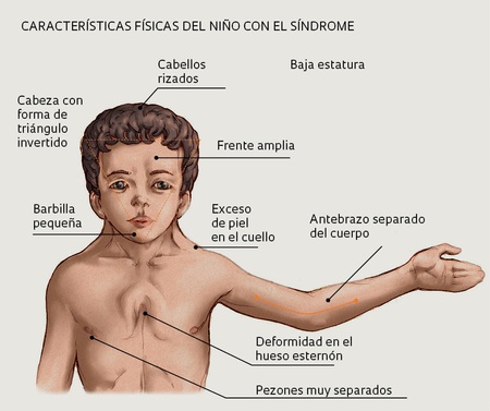 Créditos a su autor. El propietario de esta imagen es el titular de sus derechos.